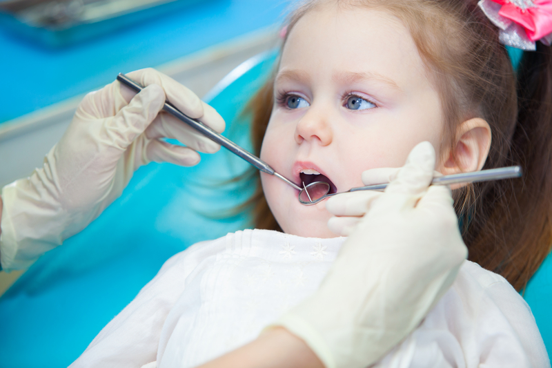 Measuring the short-term impact of fluoridation cessation on dental caries in Grade 2 children using tooth surface indices